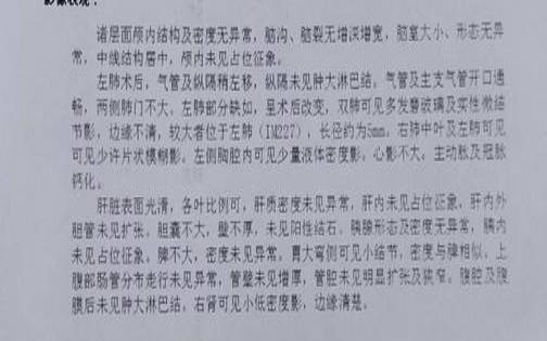 高品质美国CN2cn2gia补货啦202,美版改双卡后弊端 高品质美国CN2cn2gia补货啦202,美版改双卡后弊端