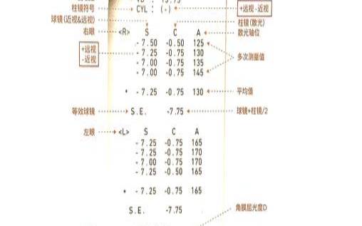 什么是P2V转换器（转换器pd是什么意思）